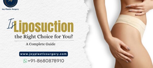 Liposuction Treatment