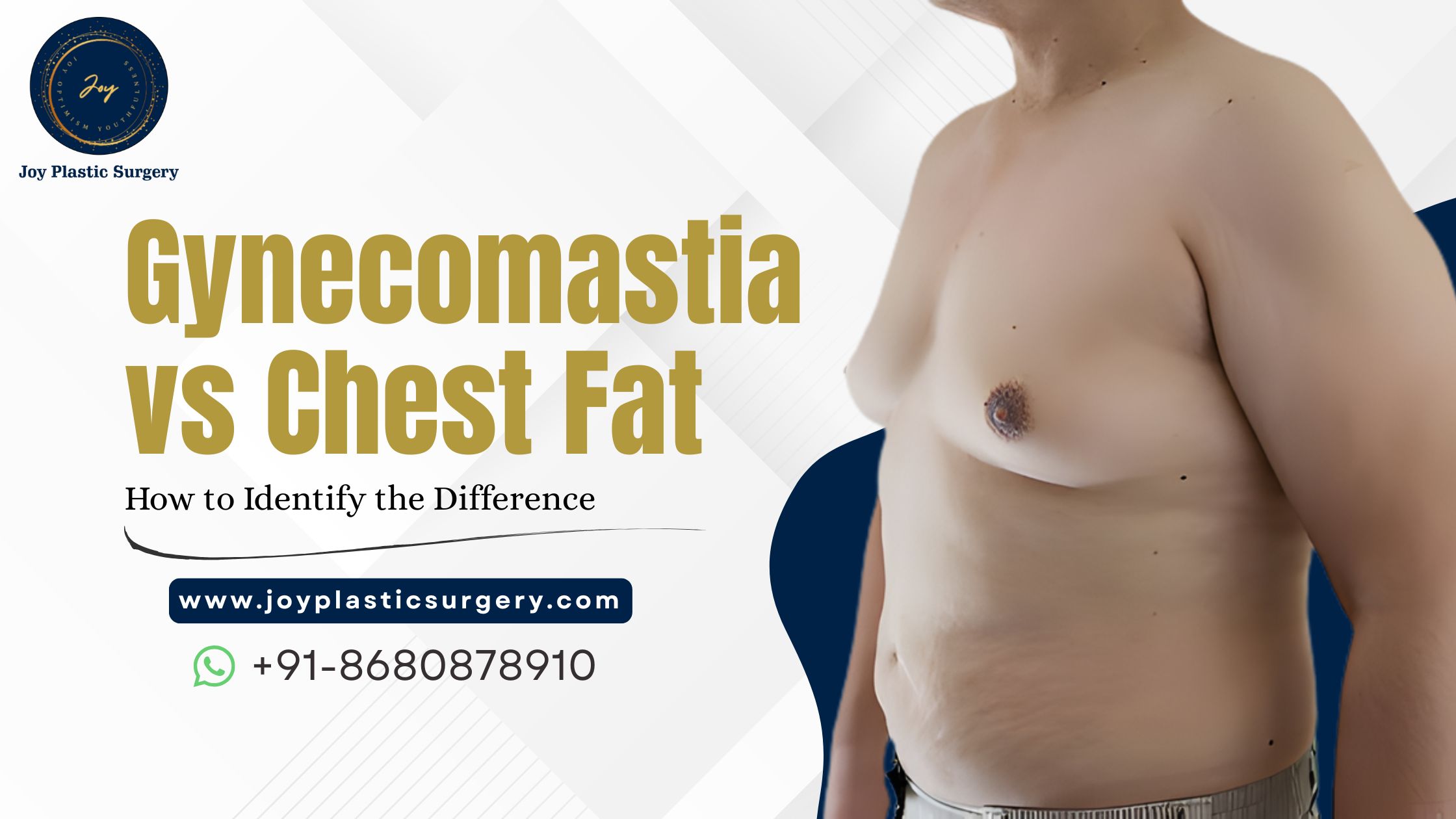 Gynecomastia vs Chest Fat