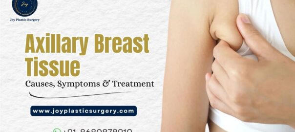 Axillary Breast Tissue