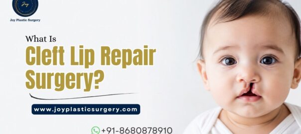 Cleft Lip Repair Surgery