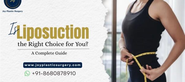 Liposuction Treatment