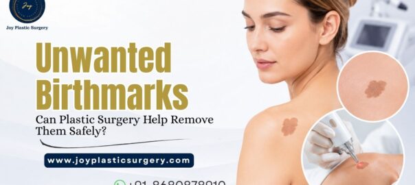 birthmark removal