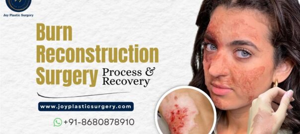 Burn Reconstruction Surgery