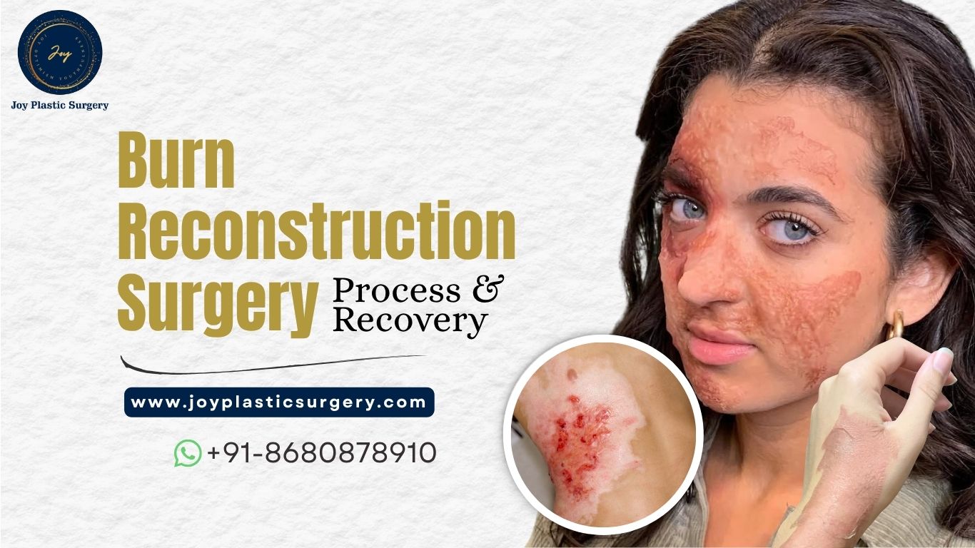 Burn Reconstruction Surgery: Process & Recovery - Joy Plastic Surgery